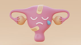 illustration sécheresse vaginale